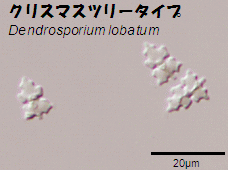 クリスマスツリータイプの半水生菌の胞子画像
